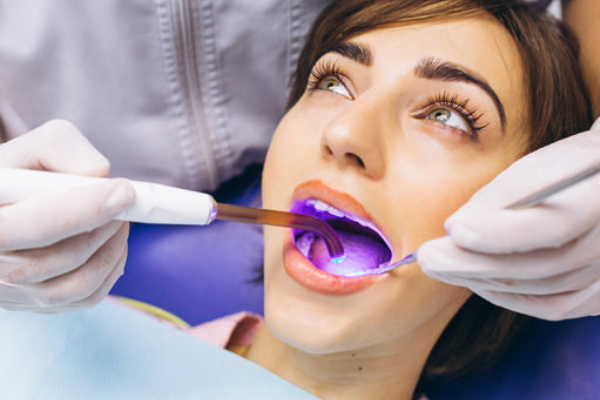 Dental Bonding
